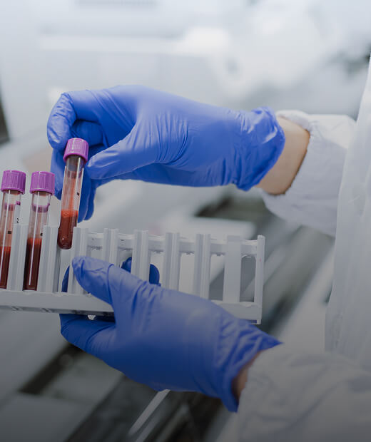 Blood samples in a labratory